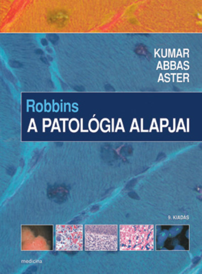 Robbins: A patológia alapjai